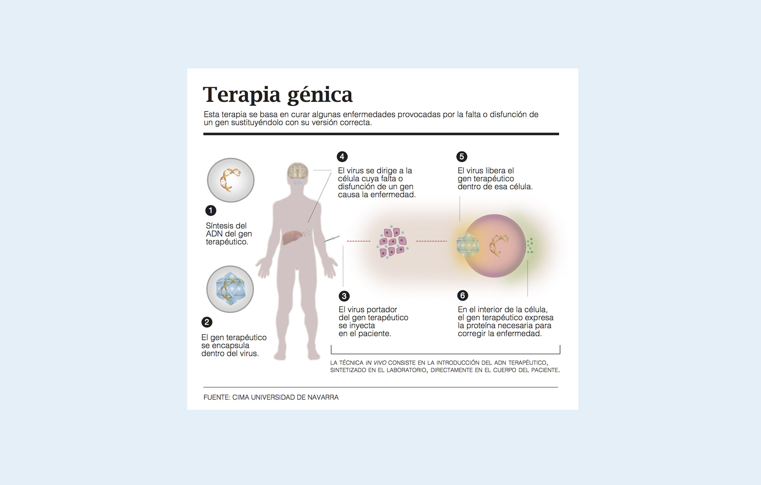 Terapia génica